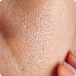 Dull Skin