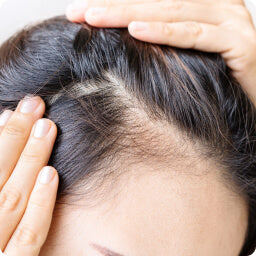 Thinning Hair